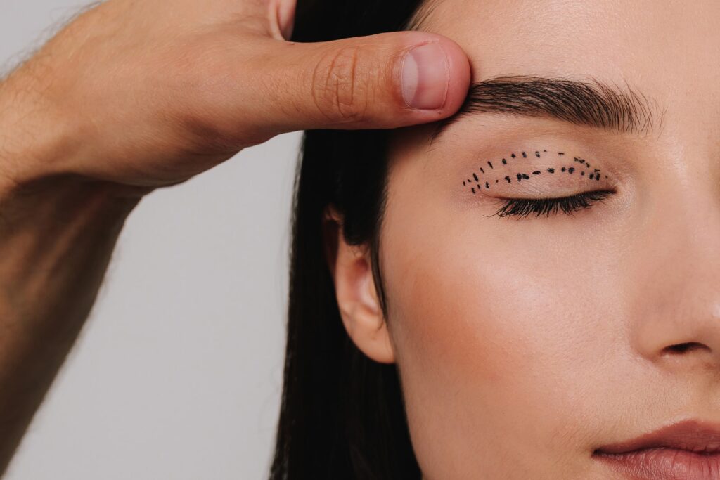 eyelid surgery